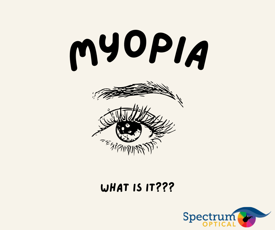 A monochromatic photo of a handrawn eye on a cream colored background with the Spectrum Optical logo and text that says, "MYOPIA: What is it?"
